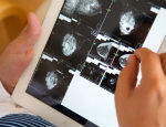 A doctor studies mammograms on a tablet computer