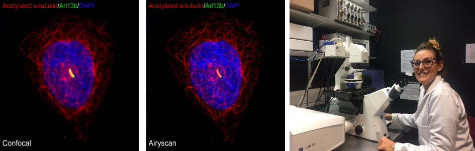 LSM 880 Laser Scanning Confocal Microscope with AiryScan (CCMF)