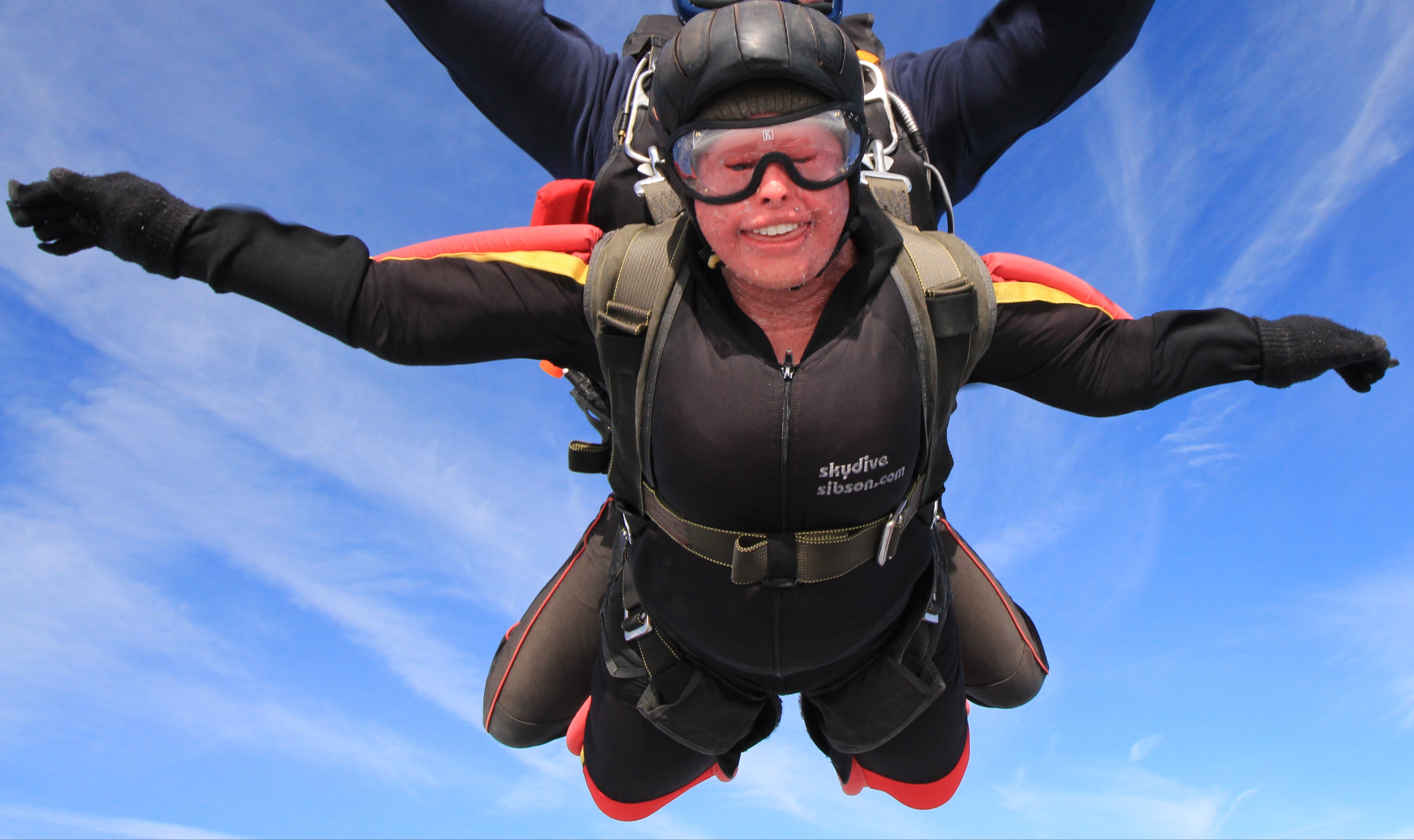 Nusrit (Nelly) Shaheen from Coventry has harlequin ichthyosis. Nelly believes in living life to the fullest. This photograph was taken during a skydive that she performed for charity in 2017.  Acknowledgement: Nusrit Shaheen.