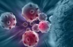 Digital graphic depicting cancer cells. Credit: istock.com/vitanovski