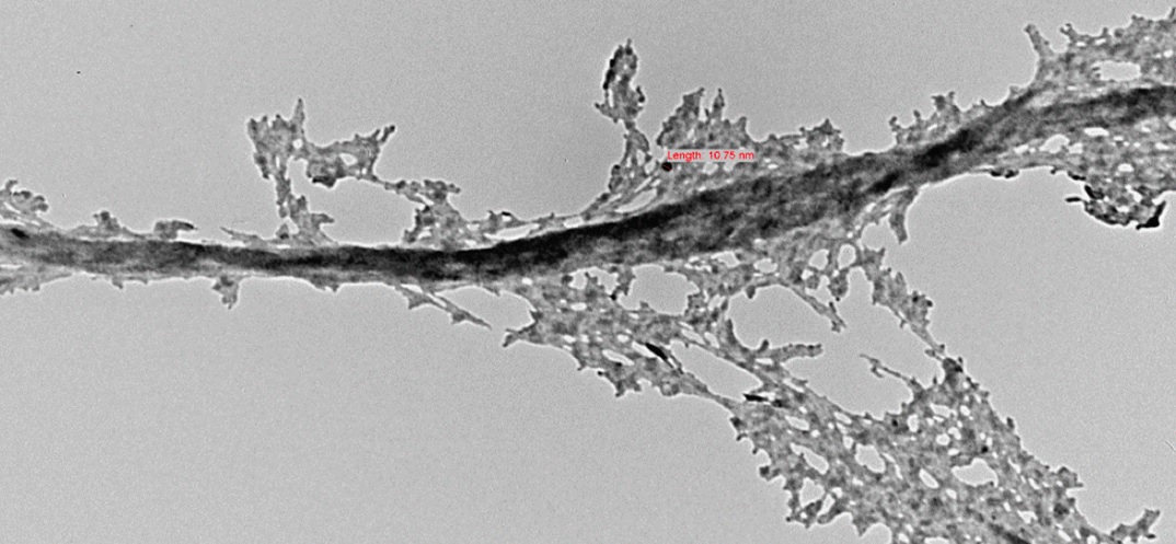 Neurodegeneration on a neuron