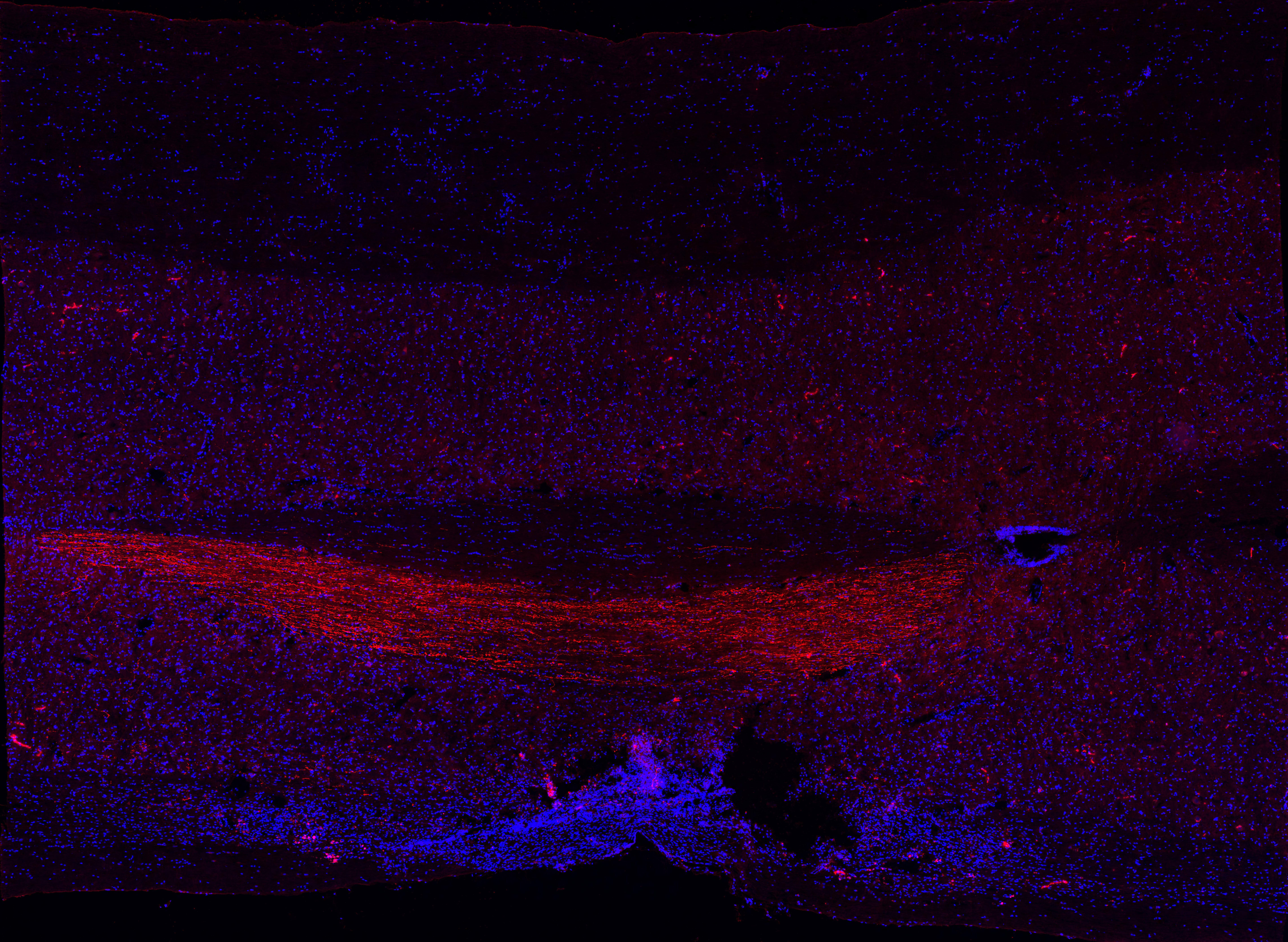 Stained and illuminated neurons