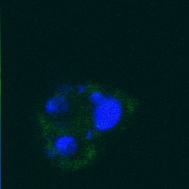 Sorted dead cell