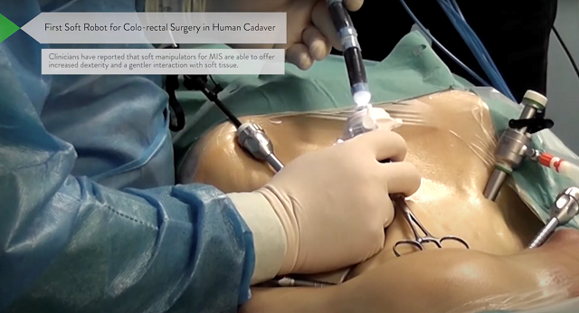 First soft robot for colo-rectal surgery in human cadaver. Credit by: STIFF-FLOP