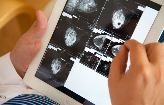 A doctor studies mammograms on a tablet computer