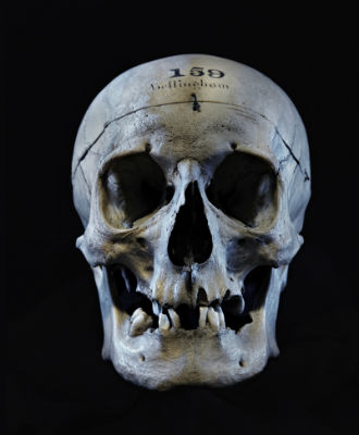 The skull of John Bellingham 