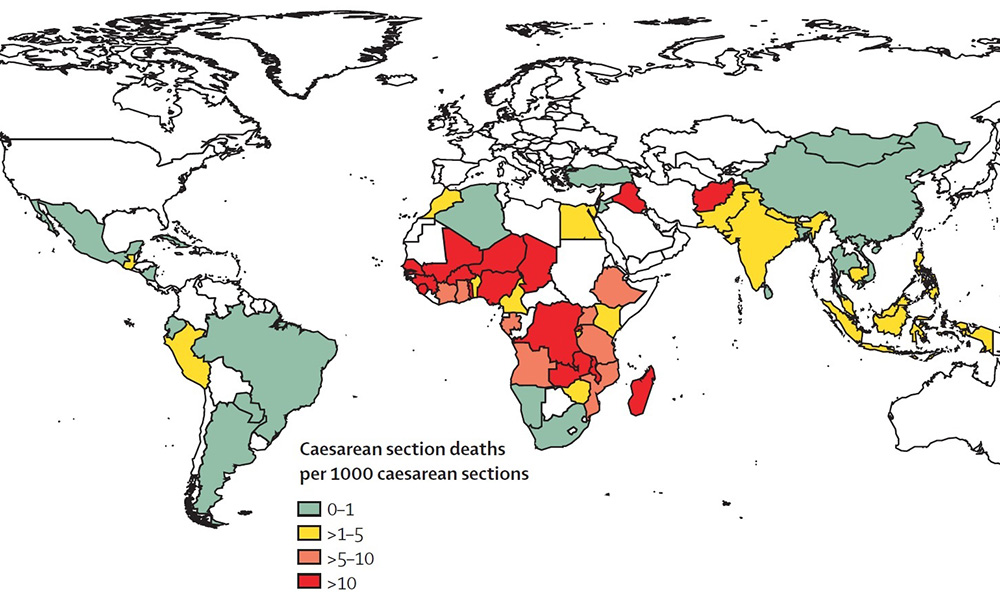 World map of maternal death risk following caesarean section in women from LMICs