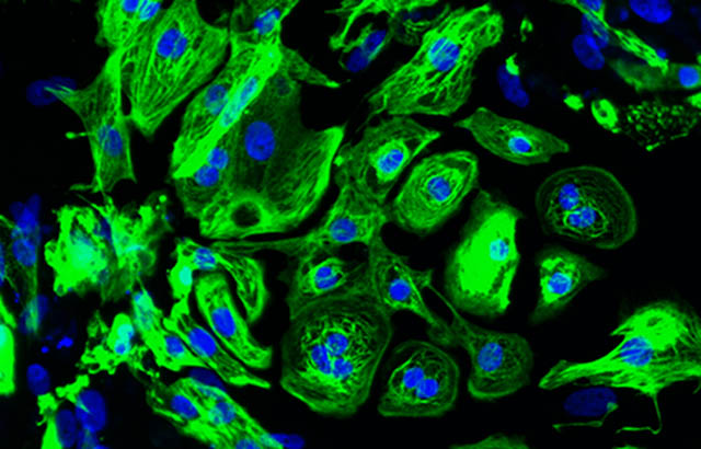 Cardiac muscle cells derived from human stem cells. Credit: Dr Yung-Yao Lin, QMUL
