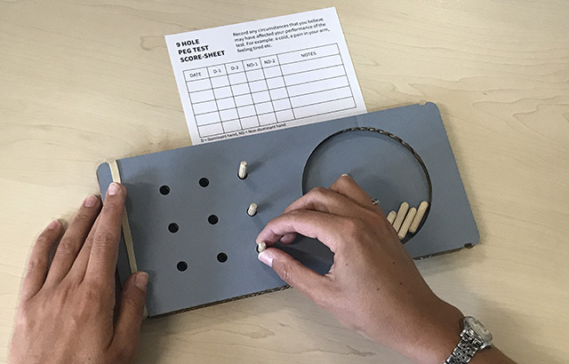 The Nine-Hole Peg Test will be used to measure hand function in severely disabled MS patients