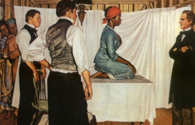 This 1952 painting by Robert Thom is the only known representation of Lucy, Anarcha and Betsey. Pearson Museum, Southern Illinois University School of Medicine