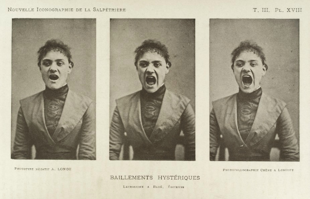 A photo by Albert Londe of a ‘hysterical’ woman taken around 1890. Wellcome Library