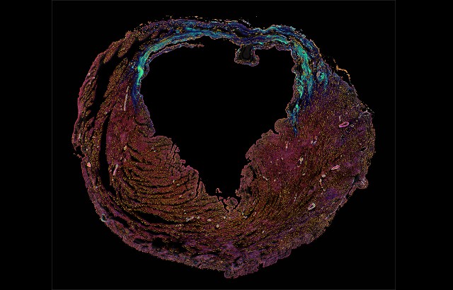 ‘A heart within a heart’, shows damage to the heart in blue after a heart attack