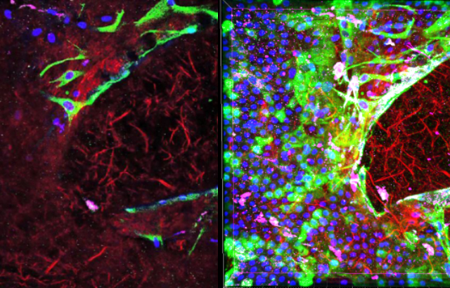 Wound healing in fetal membrane tissue. Images show the protein collagen (left) and cells (right).