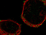 This photo shows cells adhering to large nanopatterns. The green dots indicate the sites of adhesions, and the red area shows where molecules responsible for contracting the cells are located.