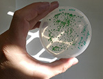 Colonies of Synechocystis bacteria