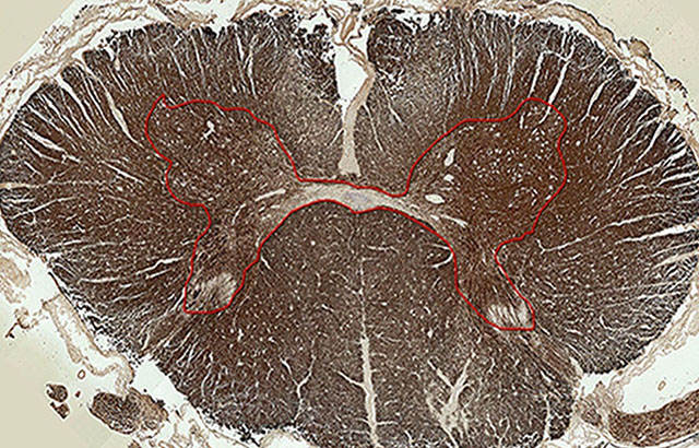 Spinal cord cross section stained for analysis