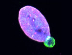 Representative images of a WM983B melanoma cell nucleus with a nuclear envelope bleb stained for Lamin A/C (green), Lamin B1 (magenta) and DNA (blue). Scale bar, 10 μm