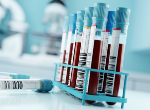 Blood samples in a laboratory. Credit: solarseven/iStock.com