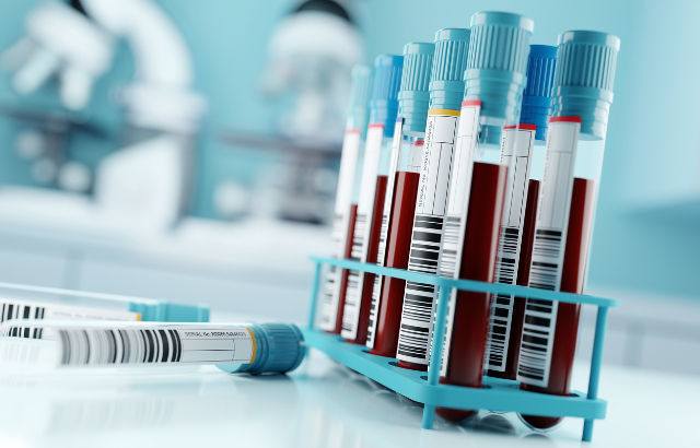 Blood samples in a laboratory. Credit: solarseven/iStock.com