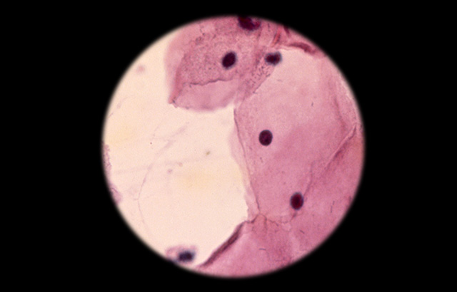 A cytologic smear under the microscope