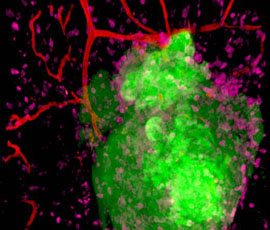 Mouse model of ovarian cancer showing cancer cells in green, immune cells in pink and blood vessels in red