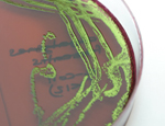 E.coli in culture