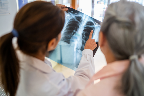 Image of - Does lung cancer screening benefit everyone? 