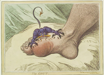 Gout illustration by James Gillray
