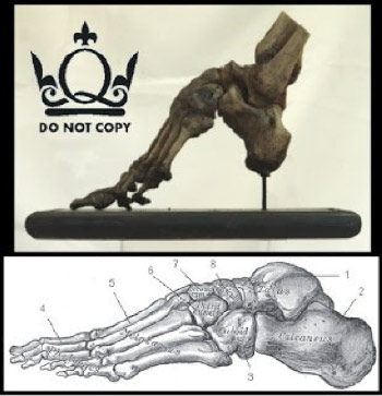 Bound Foot skeleton in our collection (TE.229) compared to 'normal' foot