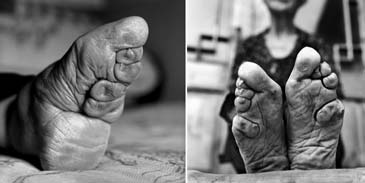 bound feet women of china