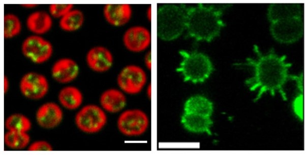 Imaging cell components in the cyanobacterium Synechocystis sp PCC6803. Left: Thylakoid membranes in red and mRNA encoding Photosystem I subunits in green. Right: Type IV pili imaged with AlexaFluor-maleimide labelling. Scale-bars are 2 microns. Credits: Moontaha Mahbub/Shylaja Mohandass.