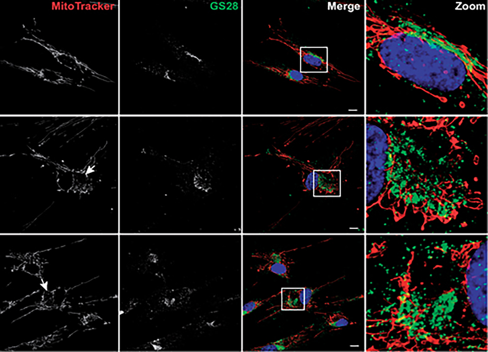 New study finds loss of Sacsin effects organisation of the cells cytoskeleton
