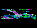 The image depicts a postcapillary venule subjected to acute inflammation and captures  neutrophils (green) transmigrating across endothelial cells junctions (blue).  Neutrophils preferably migrate across contacts between autophagy deficient endothelial cells (magenta).
