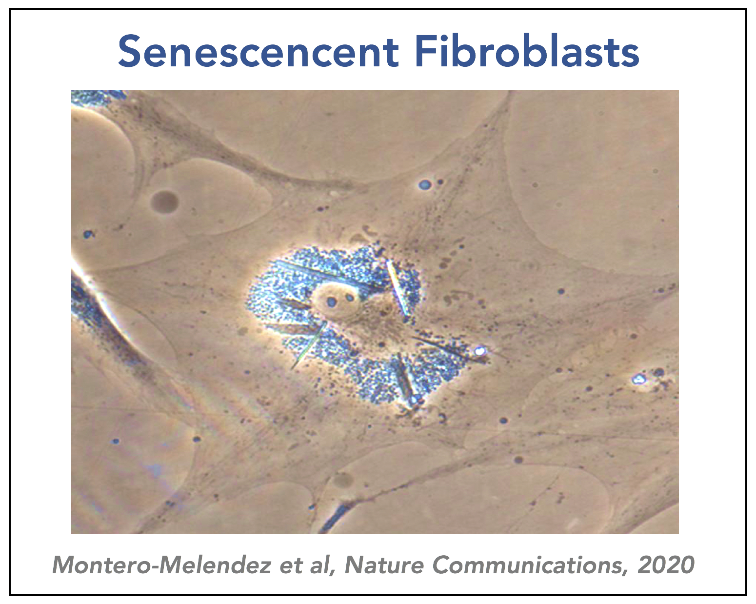 Senescence Fibroblasts
