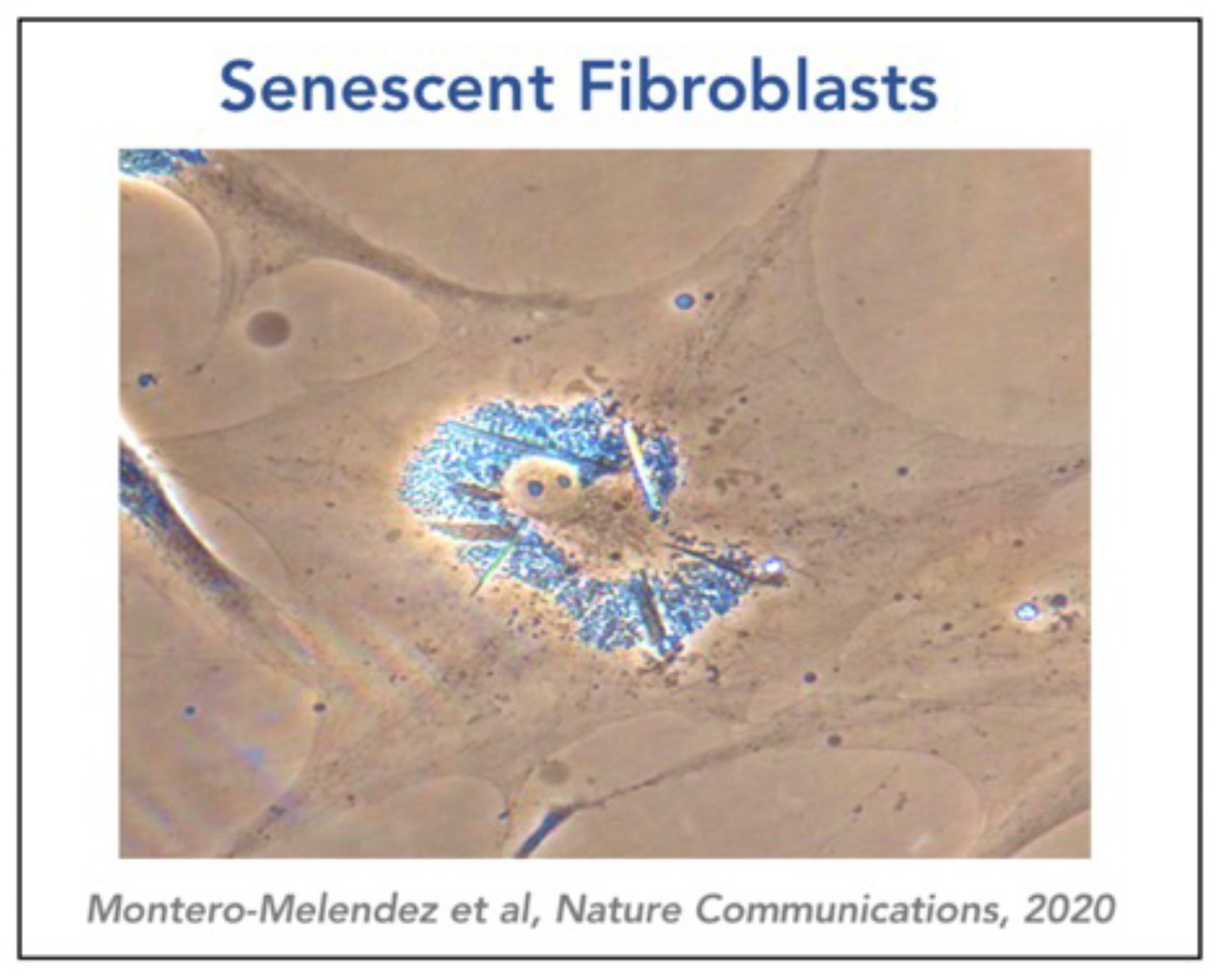 Senescence Fibroblasts