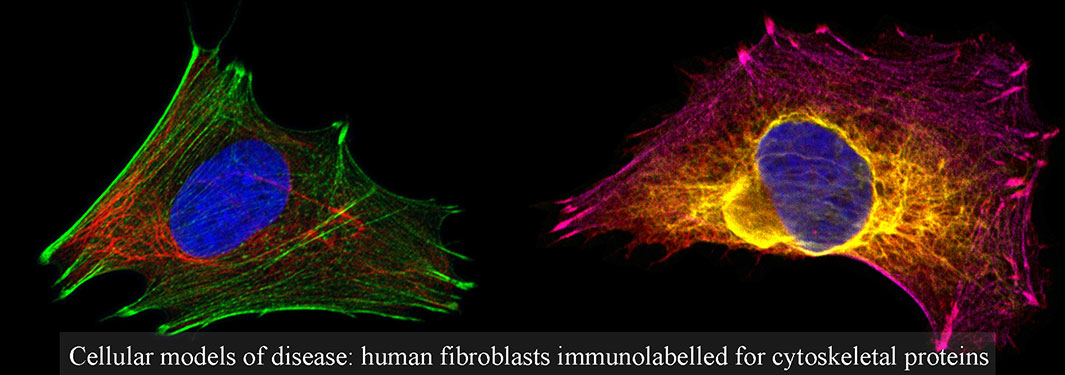 Cellular Models of disease: human fibroblasts immunolablled for cytoskeletal proteinsCellular Models of disease: human fibroblasts immunolablled for cytoskeletal proteins